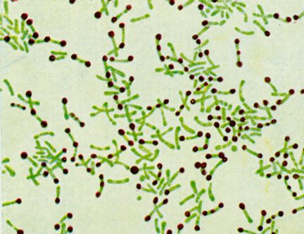 Corynebacterium diphtheriae