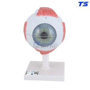 Mô Hình Mắt Với Các Bệnh Đục Thủy Tinh Thể - 1000255 - 3B