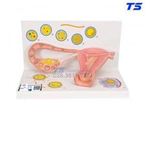 Mô Hình Tử Cung Và Buồng Trứng - 1000320 - 3B