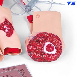 Mô Hình Khuôn Mô Phỏng Các Miếng Vết Thương Kit Ii - 1005709 - 3B