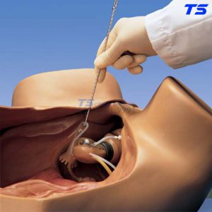 Mô Hình Thực Hành Triệt Sản - 1005797 - 3B
