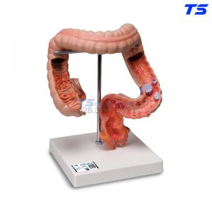 Mô Hình Ruột Già - 1008496 - 3B