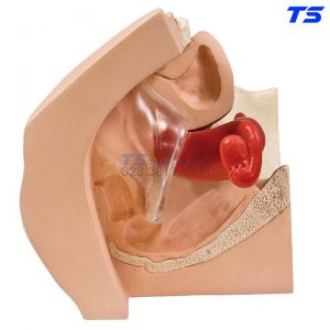 Mô Hình Thực Hành Đặt Và Tháo Dụng Cụ Tử Cung - 1013705 - 3B