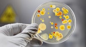Cách sử dụng đĩa petri trong nuôi cấy vi sinh vật
